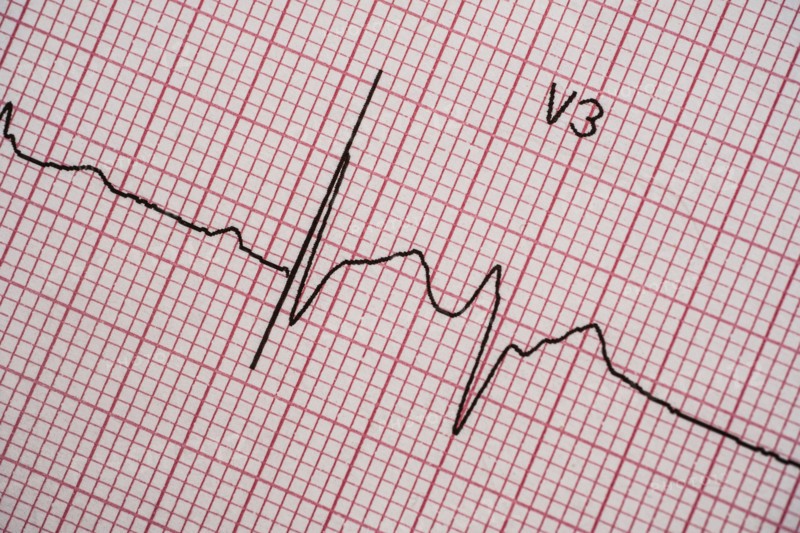 Electrocardiogram on red graph paper