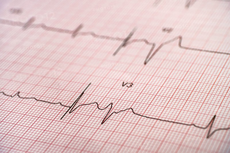 Electrocardiogram on red graph paper