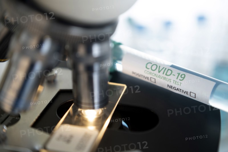 Laboratory microscope with a slide and vial of coronavirus test