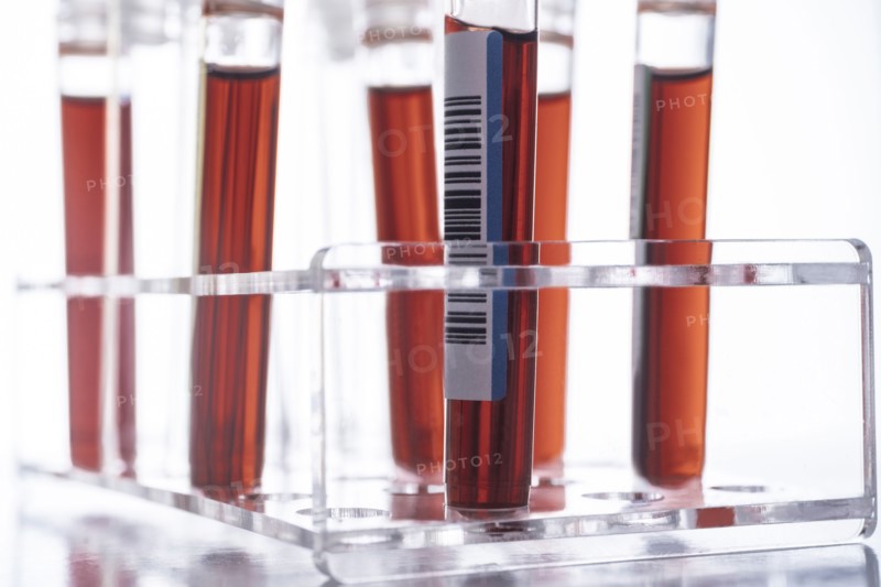 Studio shot of Covid-19 blood samples in test tube rack