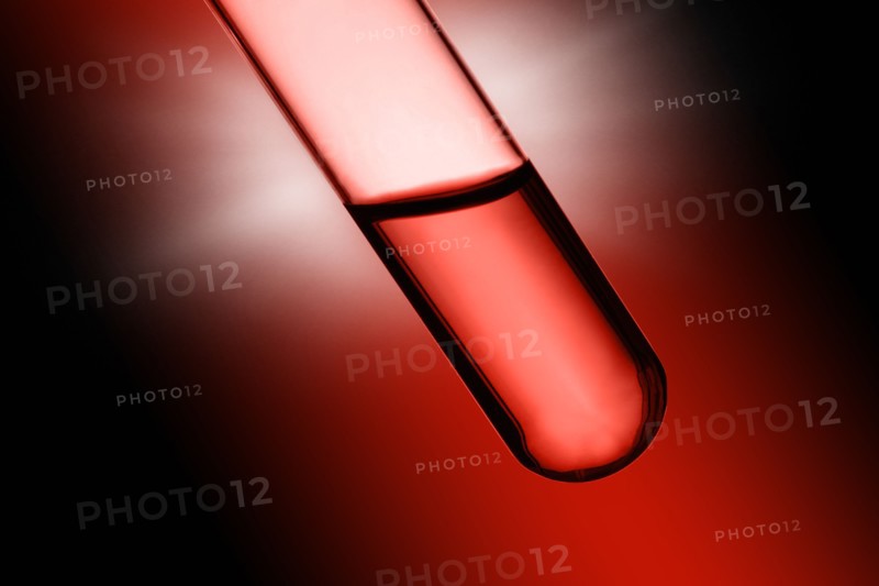 Close-up of blood sample