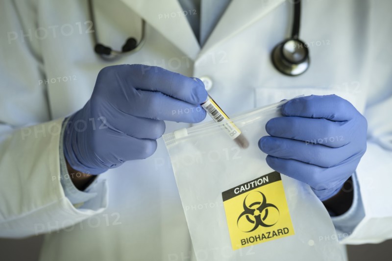 Close-up of doctors hands holding test tube with blood and bag with biohazard sign
