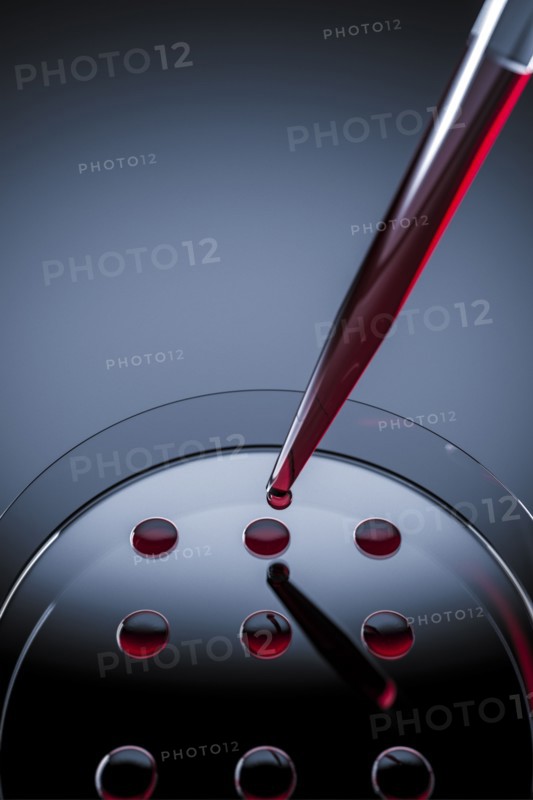 Blood sample tested on petri dish in laboratory