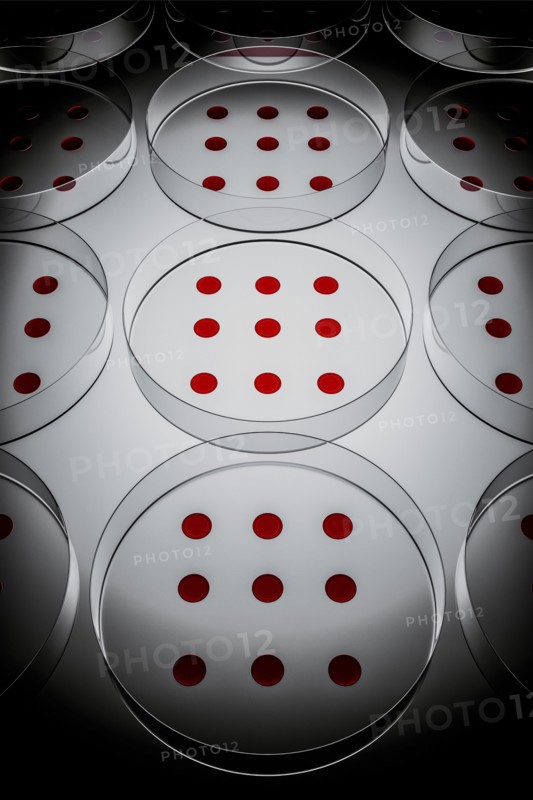Blood sample tested on petri dish in laboratory