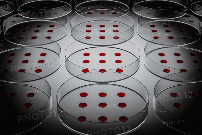 Blood sample tested on petri dish in laboratory
