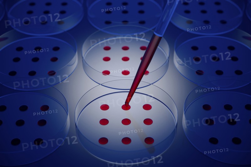 Blood sample tested on petri dish in laboratory