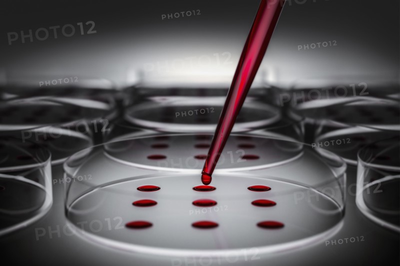 Blood sample tested on petri dish in laboratory
