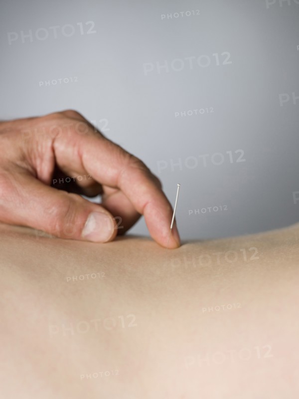Close up of acupuncturist checking needle in back of patient