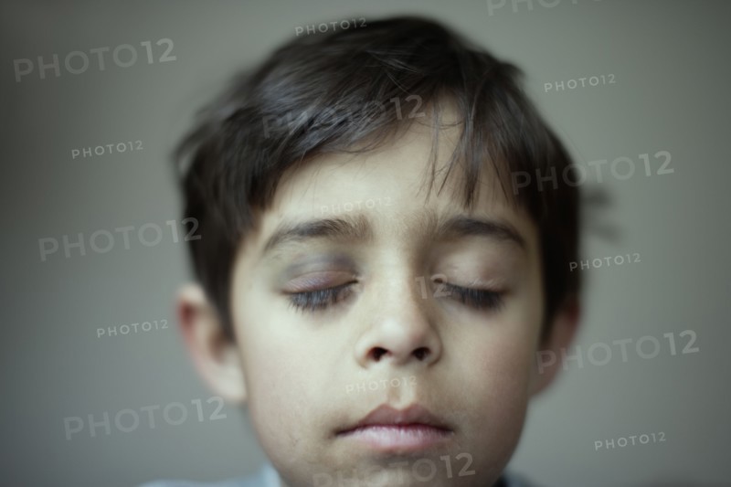 Mixed race boy with black eye
