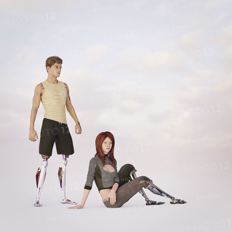 Man and woman with prosthetic legs