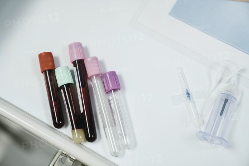 Test tubes with caps on table near syringe
