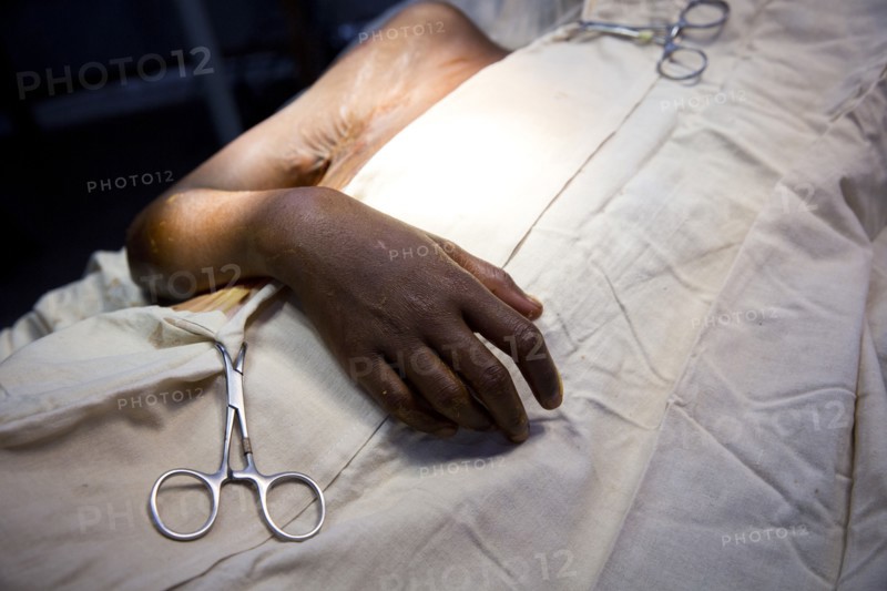 Close up of patient laying in surgery
