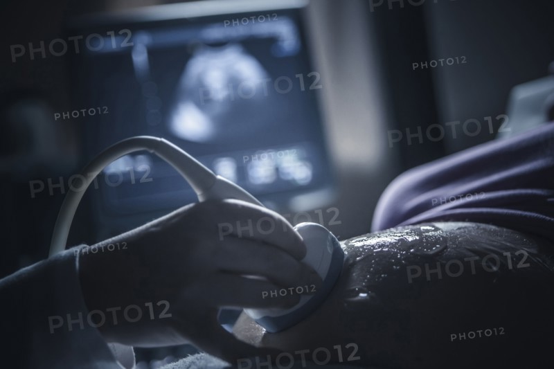 Pregnant woman having sonogram