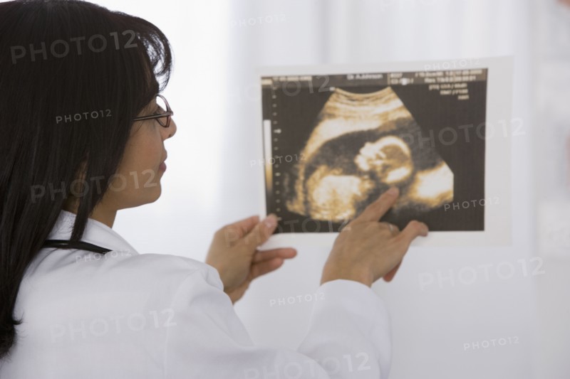 Female doctor looking at sonogram