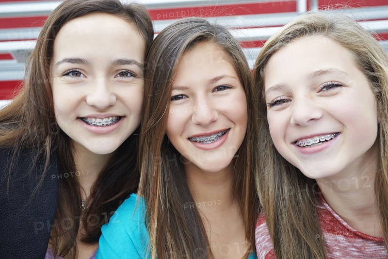 Teenage girls showing off braces together