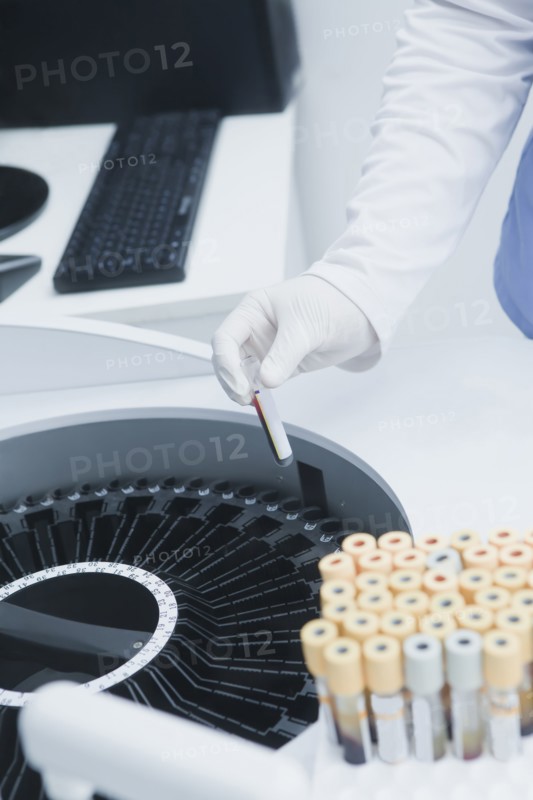 Hispanic scientist testing blood sample in laboratory centrifuge