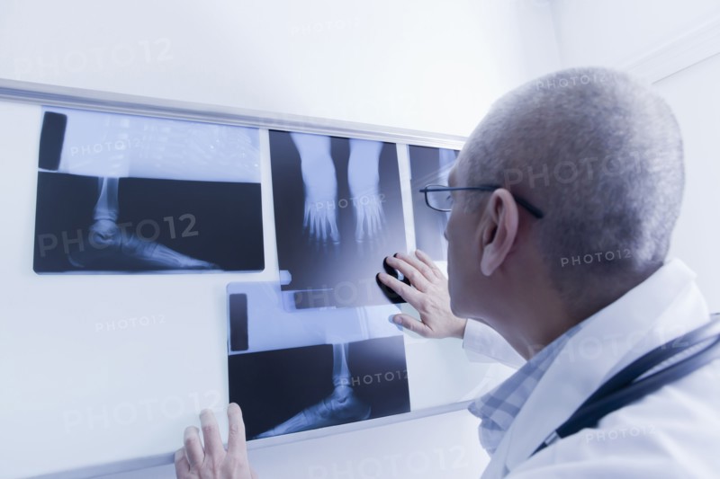 Hispanic doctor examining x-rays