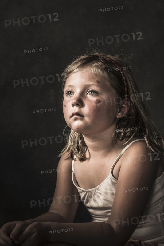 Sad Caucasian girl with scratches on her face