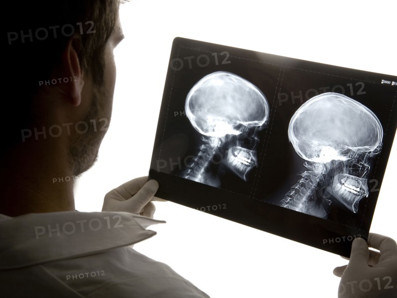 Caucasian doctor examining x-rays in hospital