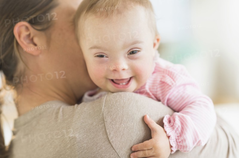 Caucasian mother holding baby girl with Down Syndrome