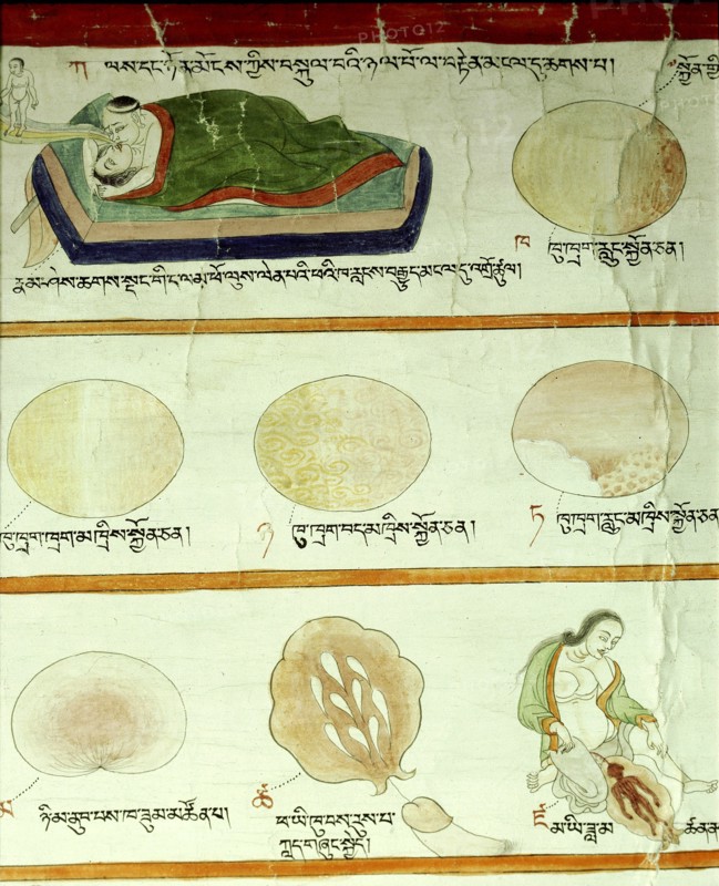 A detail of a medical thangka from a version of the commentary on the ancient Four Tantras, the fundamental treatise of Tibetan medicine