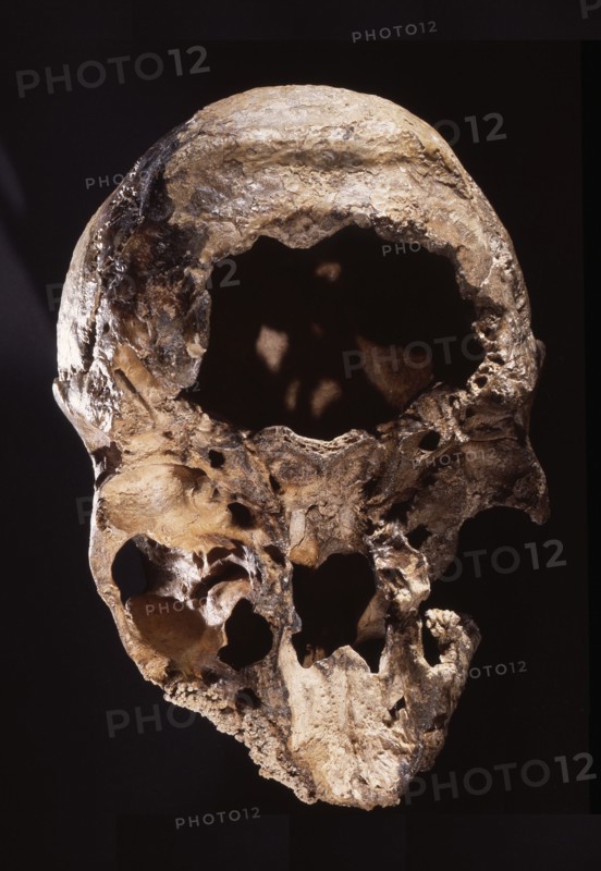 Neanderthal skull