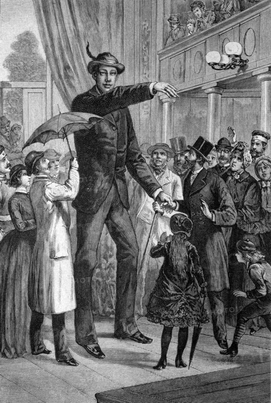 Giant franz winkelmeier