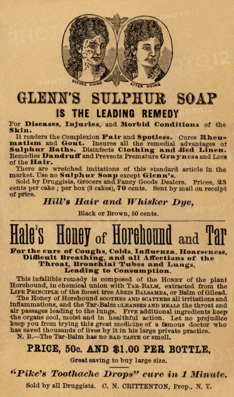 Glenn's Sulphur Soap is the Leading remedy 1890