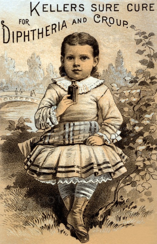 Keller's Sure Cure for Diptheria and Croup 1890