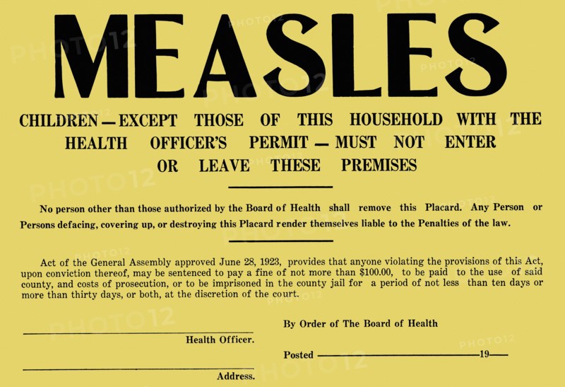 Measles