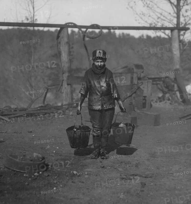 Boy with crushed leg works in the mines. 1906