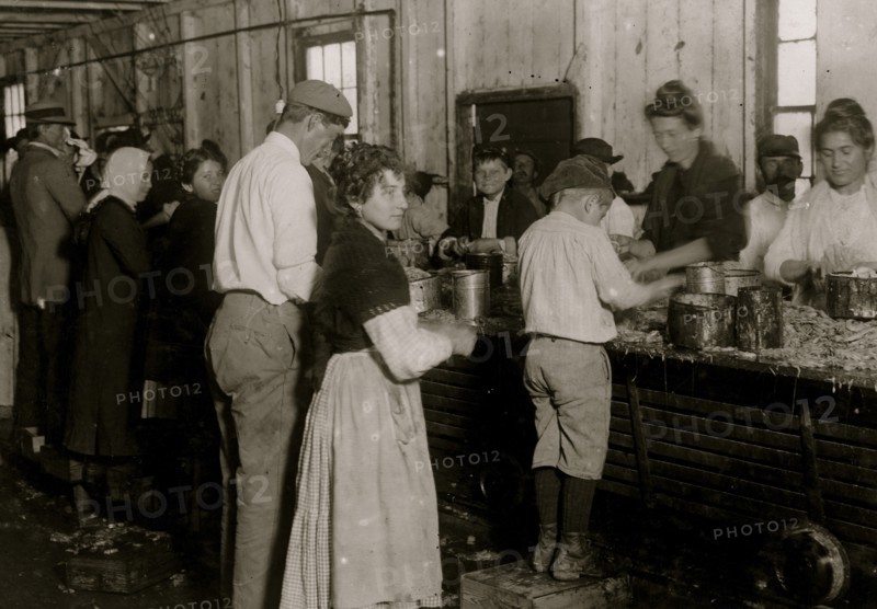 Young shrimp-pickers at Dunbar, Lopez, Dukate Co., Sore, swollen, and even bleeding fingers are common among these workers on account of the acid in the shrimp. 1911
