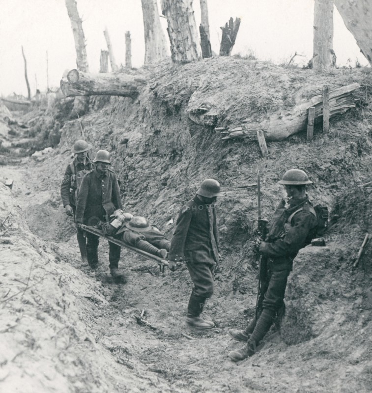 Stereoview WW1