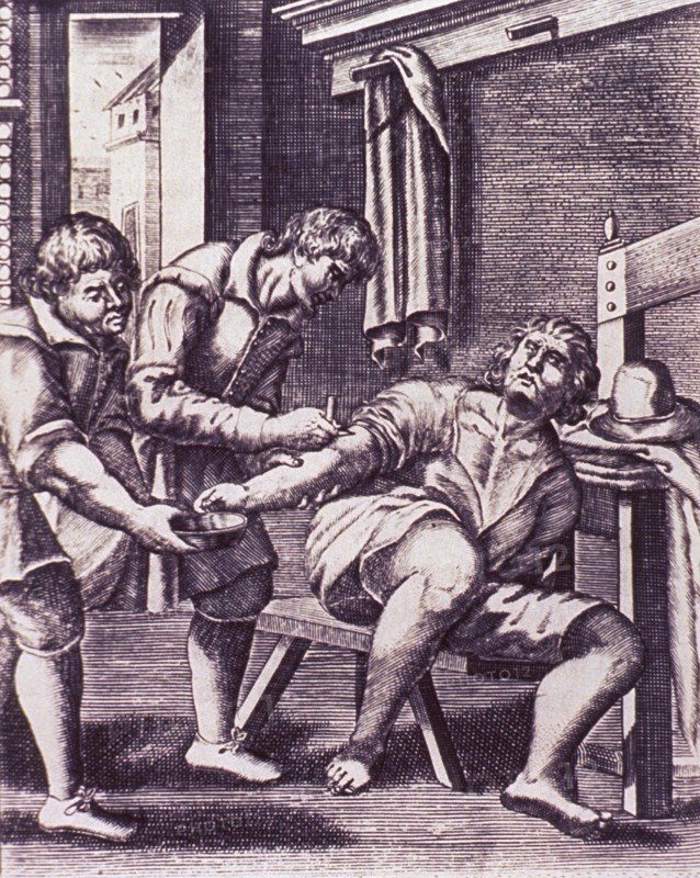 Venesection on male patient