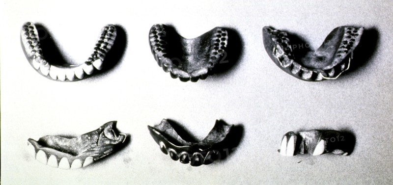 Japanese wooden dentures