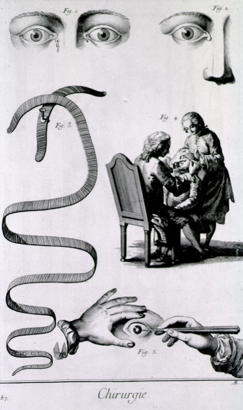 Eye maladies ca. 1700s
