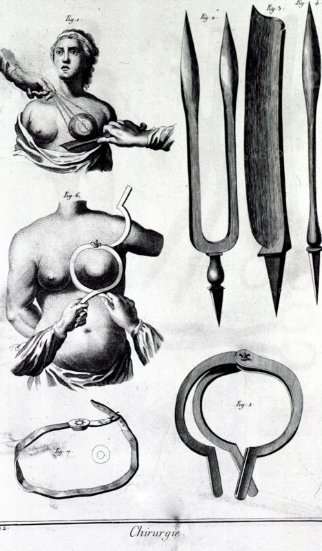 Instruments for breast surgery ca. 1700s