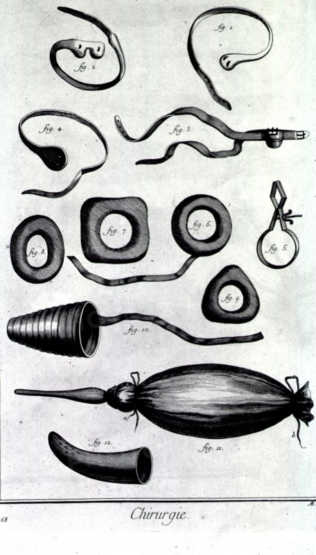 Devices to correct medical conditions of the groin ca. 1700s