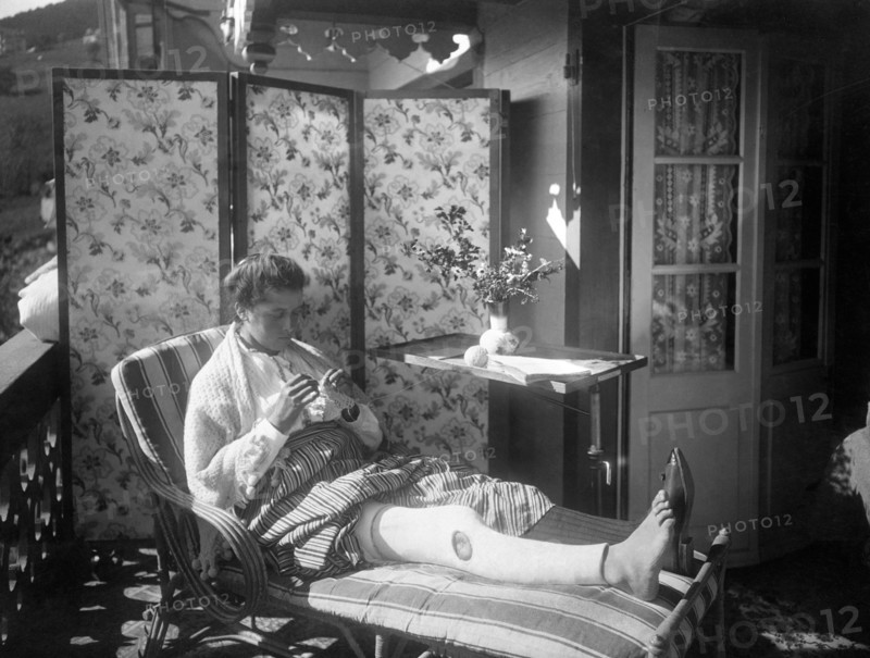 italy, valle d'aosta,  sanatorium, woman with plaster cast leg, 1910-20