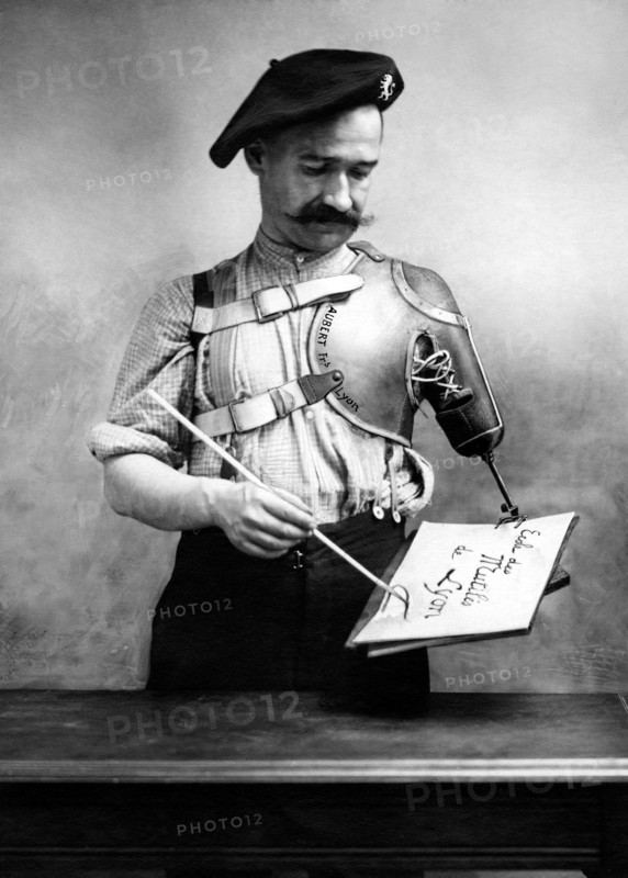 mutilations, prothèses pour les amputés de guerre, 1915 1918
