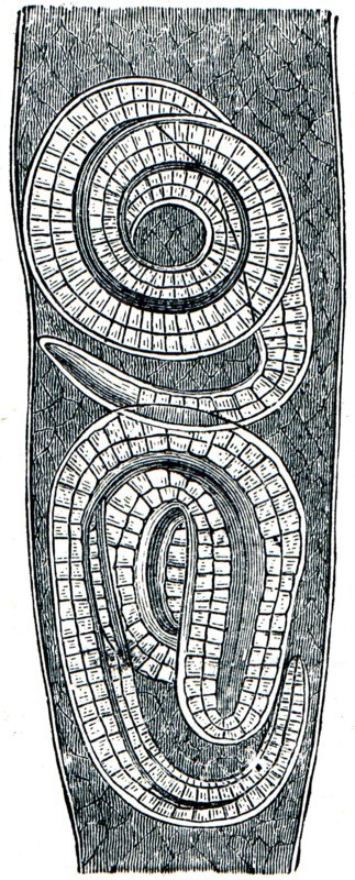 Free trichina in the muscle fibers.