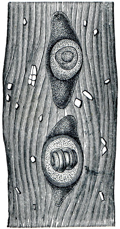 Trichina in the capsule of the muscle fibers.