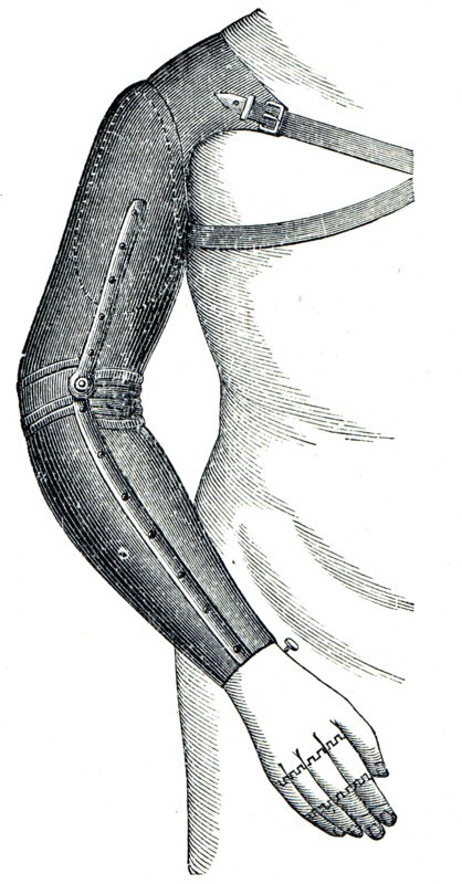 Artificial arm.