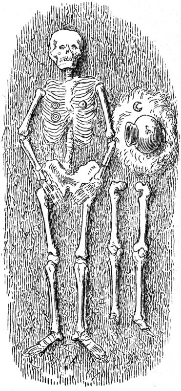 Double grave.