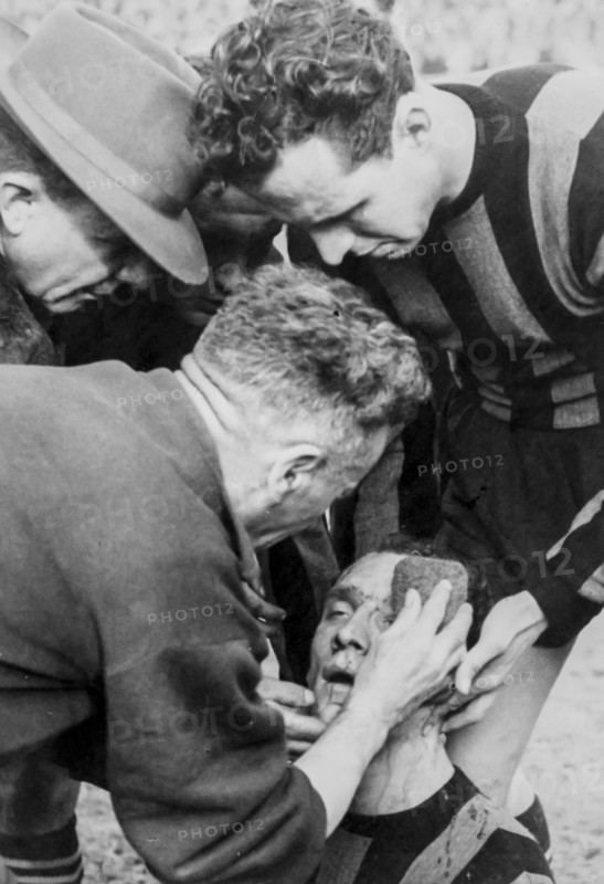 Juventus - inter 1946, milini injuried