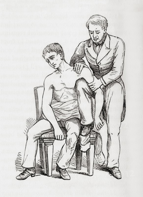 Method of reducing dislocation of the shoulder with knee in armpit.