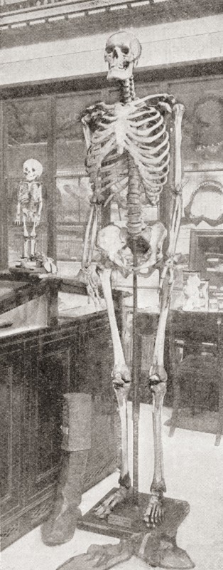 The skeletons of Charles Byrne.