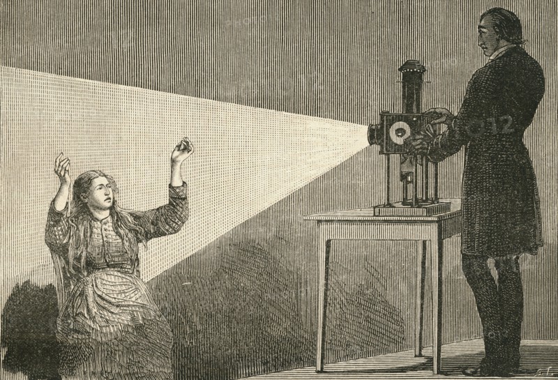 Catalepsy produced by electric light.