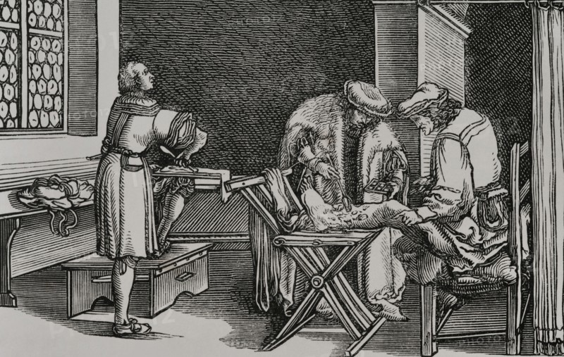 German surgeon. Facsimile of an engraving attributed to Hans Holbein, in the German translation of Boethius ""Consolatio Philosophiae"", published in Augsburg in 1537. Sciences & Lettres au Moyen Age et a l'epoque de la Renaissance. Paris, 1877.