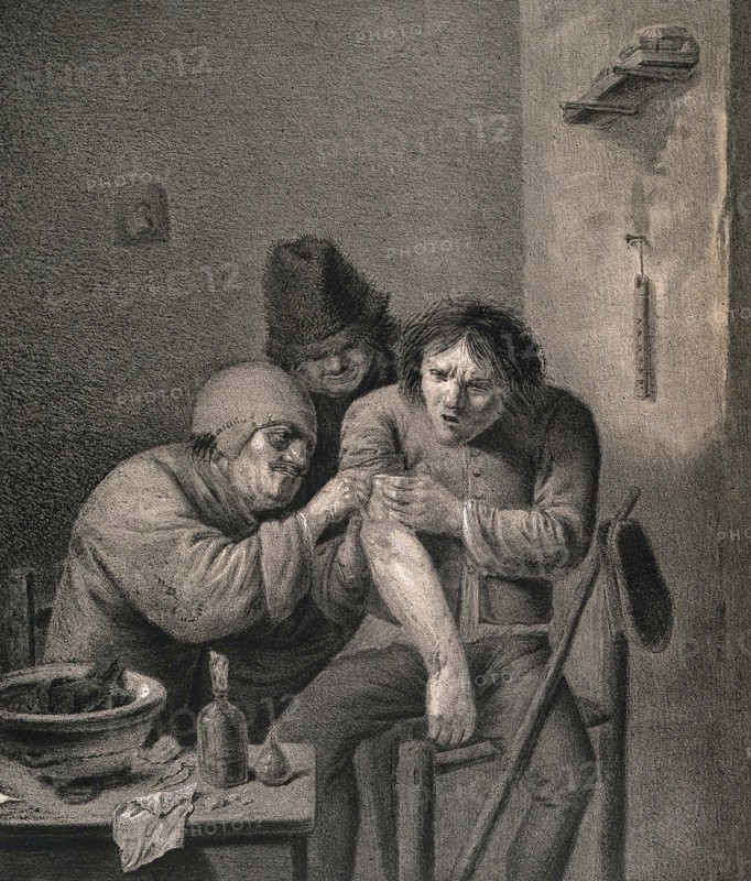 surgeon dresses the wound of a grimacing patient, Wounds and injuries, treatment in 17th century Netherlands, Historical, digitally restored reproduction from a 19th century original..